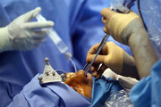 اینفوگرافیک | ایران رتبه اول جراحی بینی در جهان