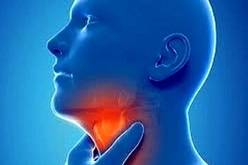 اینفوگرافیک | نشانه‌های گلودرد ویروسی