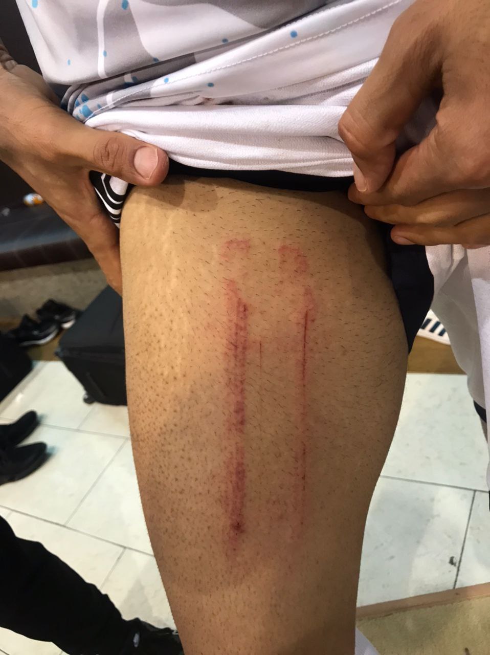 مدافع پیکان برای اخراج عالیشاه مدرک نشان داد/عکس