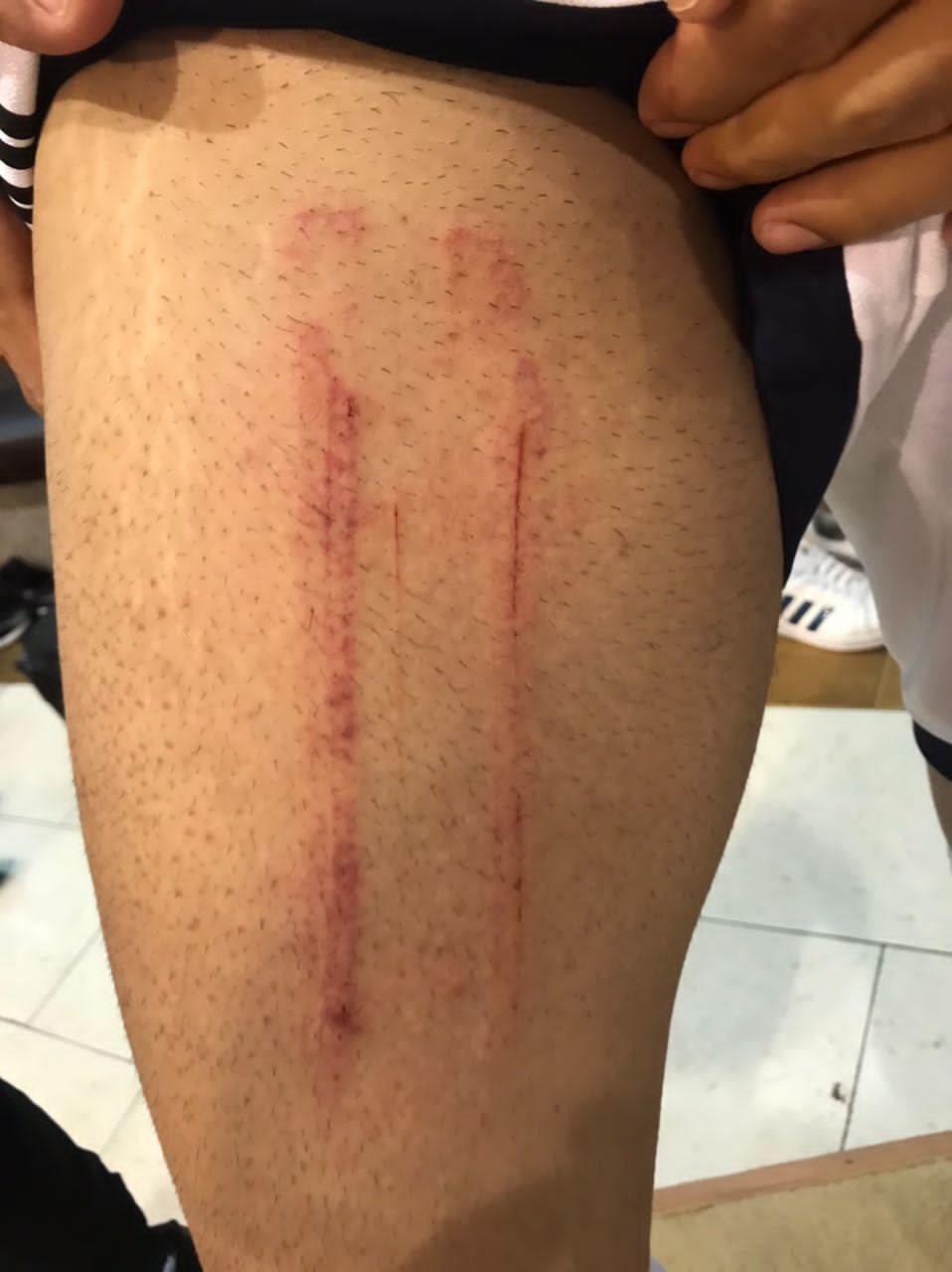 مدافع پیکان برای اخراج عالیشاه مدرک نشان داد