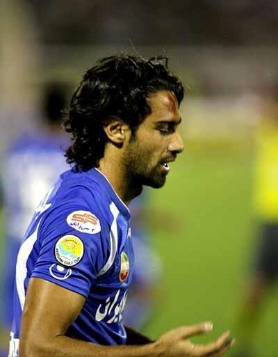 وقتی سنگهای تبریز پیشانی مجیدی را زخمی کرد!/عکس