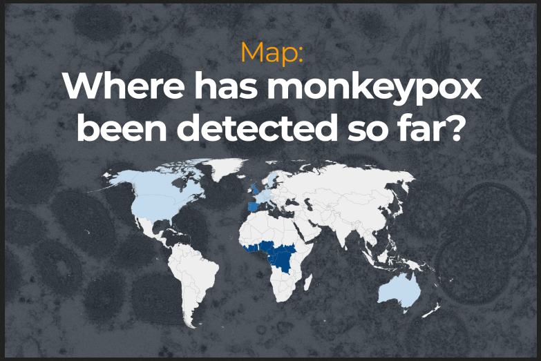 5700716 - شیوع آبله میمون؛ کدام کشورها درگیر شده‌اند؟