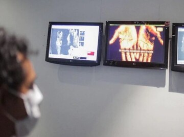 شیوع آبله میمونی تا چه میزان نگرانکننده است؟ شیوع آبله میمونی تا چه میزان نگرانکننده است؟