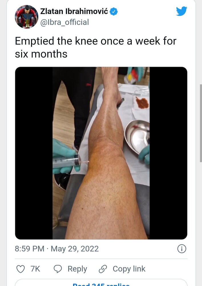 زلاتان 6 ماه اینگونه برای میلان بازی کرد / عکس 2