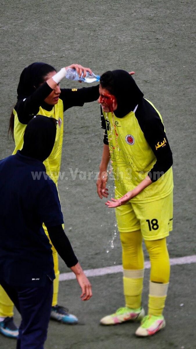 5702734 - تصویری وحشتناک از فوتبال زنان ایران/عکس