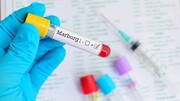 احتمال شیوع یک ویروس کشنده دیگر؛ علائم و ویژگی‌های «ماربورگ» را بشناسید