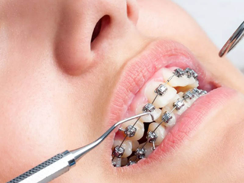 انتخاب بهترین متخصص ارتودنسی در غرب تهران