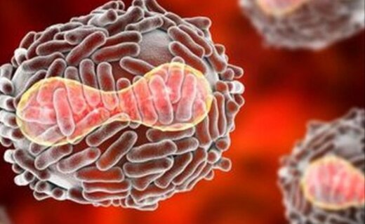 اینفوگرافیک | علائم و ویژگی‌های ویروس کشنده «ماربورگ» را بشناسید
