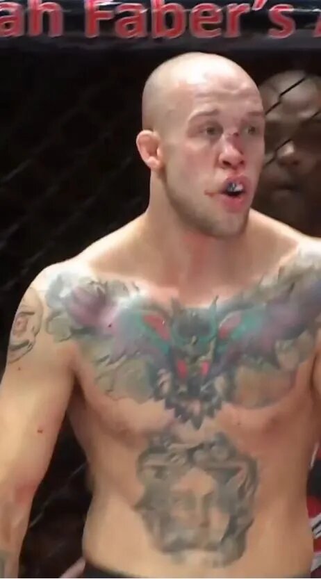 تصاویر وحشتناک از شکستگی بینی مبارز MMA