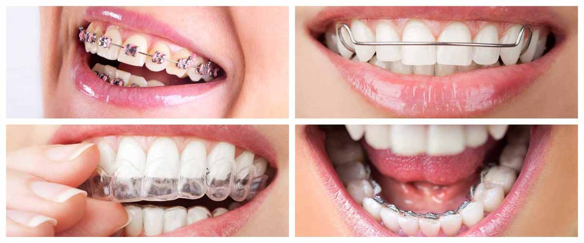 چگونه یک متخصص ارتودنسی خوب و متبحر در کرج پیدا کنیم
