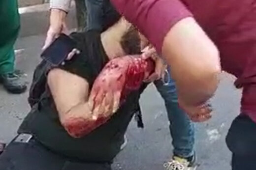 ببینید | تصاویر هولناک از چاقو زدن به یک جوان در پارک قیطریه تهران و سرقت موبایل!