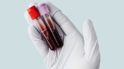 خون آزمایشگاهی برای اولین بار به انسان‌ها تزریق شد