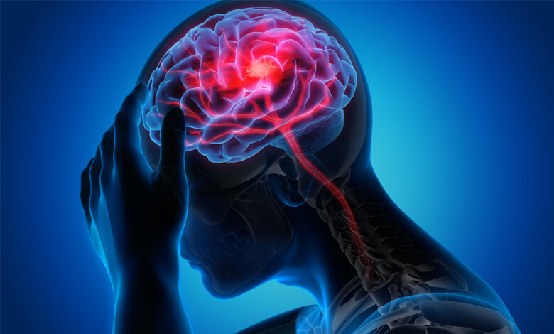 علائم هشدار دهنده‌ سکته مغزی/ راهکار ساده برای کاهش ریسک سکته مغزی