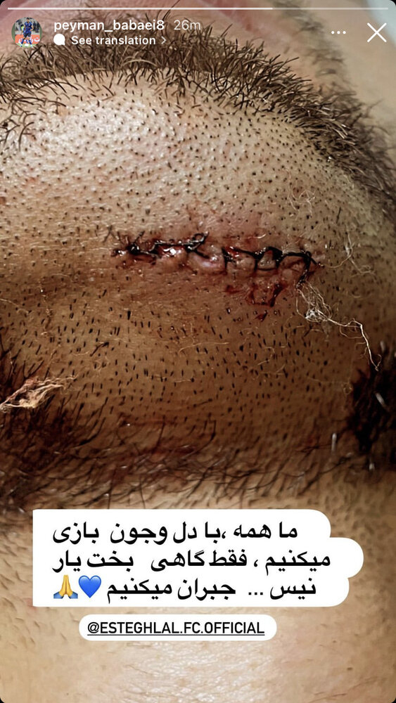 کار ستاره استقلال به بخیه کشیده شد!/عکس