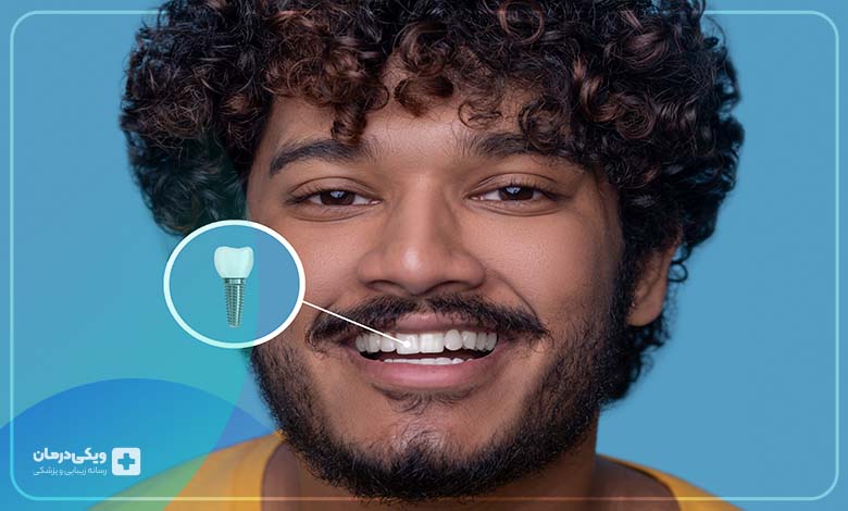 تبلیغات موثر برای متخصصین ایمپلنت و ارتودنسی در تهران چیست؟