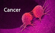 هشدار محققان نسبت به افزایش چندین برابری یک نوع سرطان