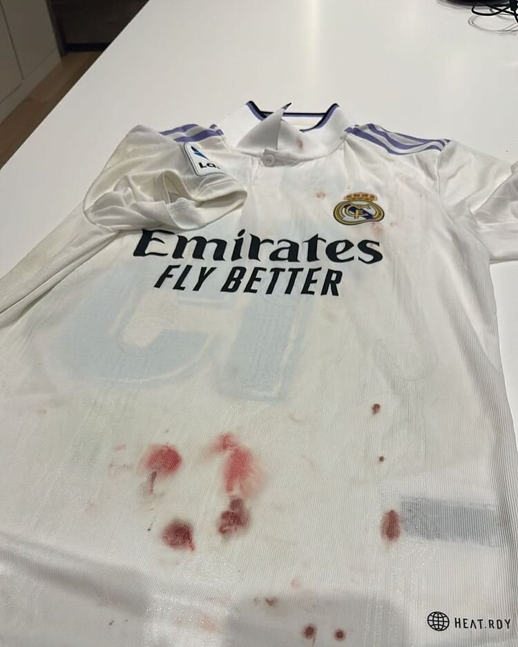 پیراهن خونین ستاره رئال؛ از جنگ برگشتی؟!/عکس