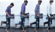پای مصنوعی هوشمند؛ امیدی تازه برای راه‌ رفتن افراد قطع عضو/ عکس