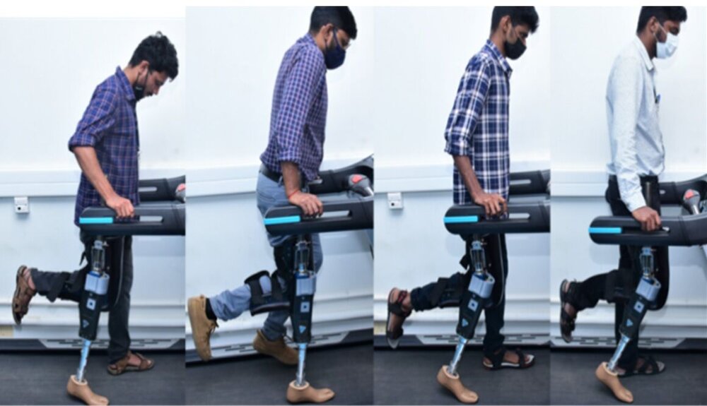 پای مصنوعی هوشمند ساخته شد/ عکس