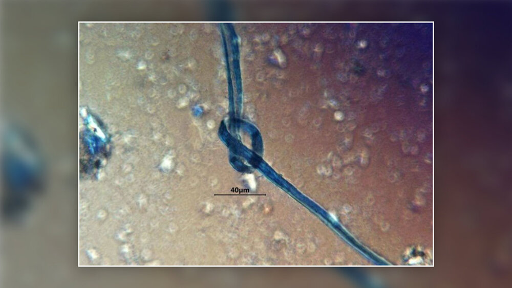 عکس | رشتهای مرموز که در دهان قربانیان رسمی قدیمی و وحشتناک پیدا شد