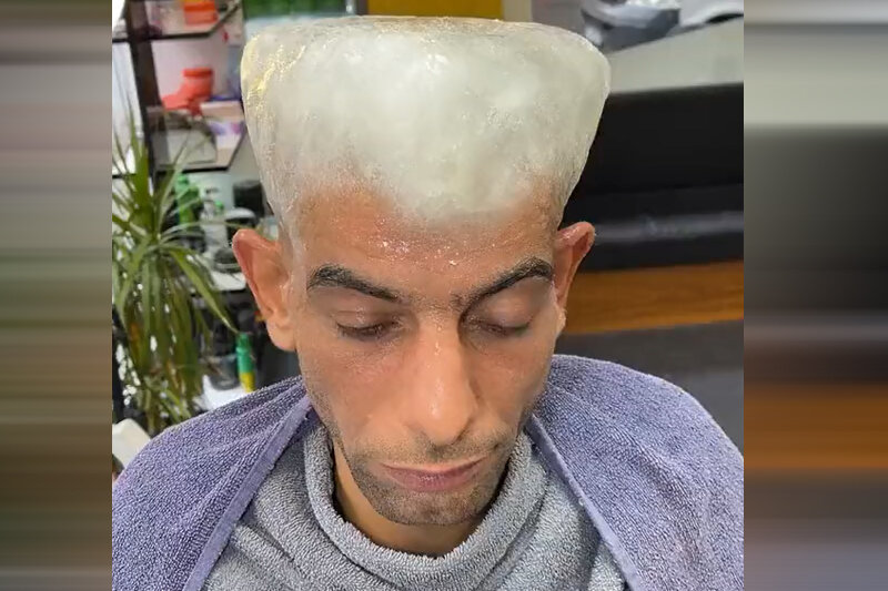 ببینید | اقدام عجیب و باورنکردنی مرد ترک؛ رفع کچلی با موهایی از جنس یخ!