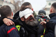 ببینید | شلیک پلیس فرانسه به چشم یک شهروند در پاریس!