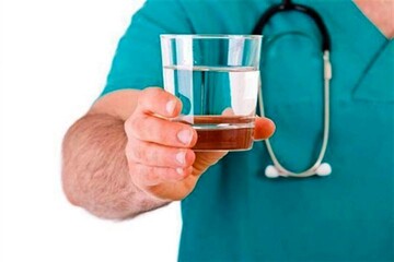 یک سوال مهم و اساسی/ روزانه چقدر آب بخوریم؟