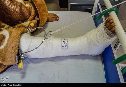 مصدومین حادثه تروریستی شیراز