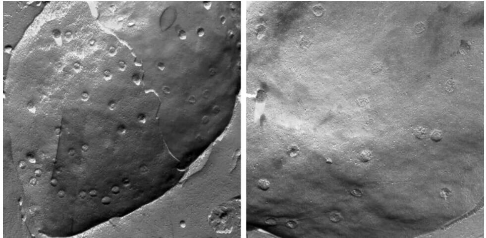 چه چیزی مانع بازسازی سلولهای قلب بزرگسالان میشود
