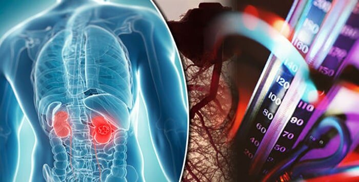 بلایی که فشارخون سر کلیهها میآورد