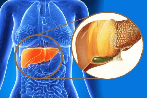 نسخه طب سنتی برای کبد چرب