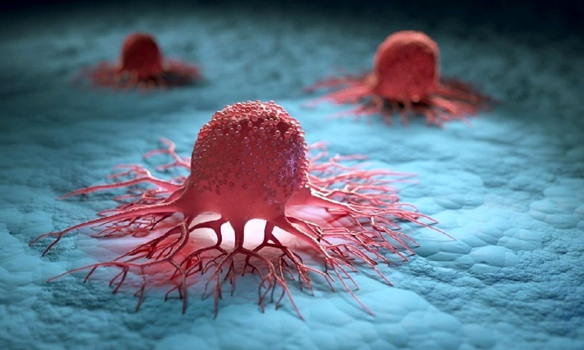 تشخیص زودهنگام انواع مختلف سرطان با این آزمایش 