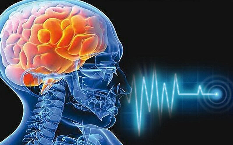 - هفت عامل باورنکردنی سکته مغزی را بشناسید