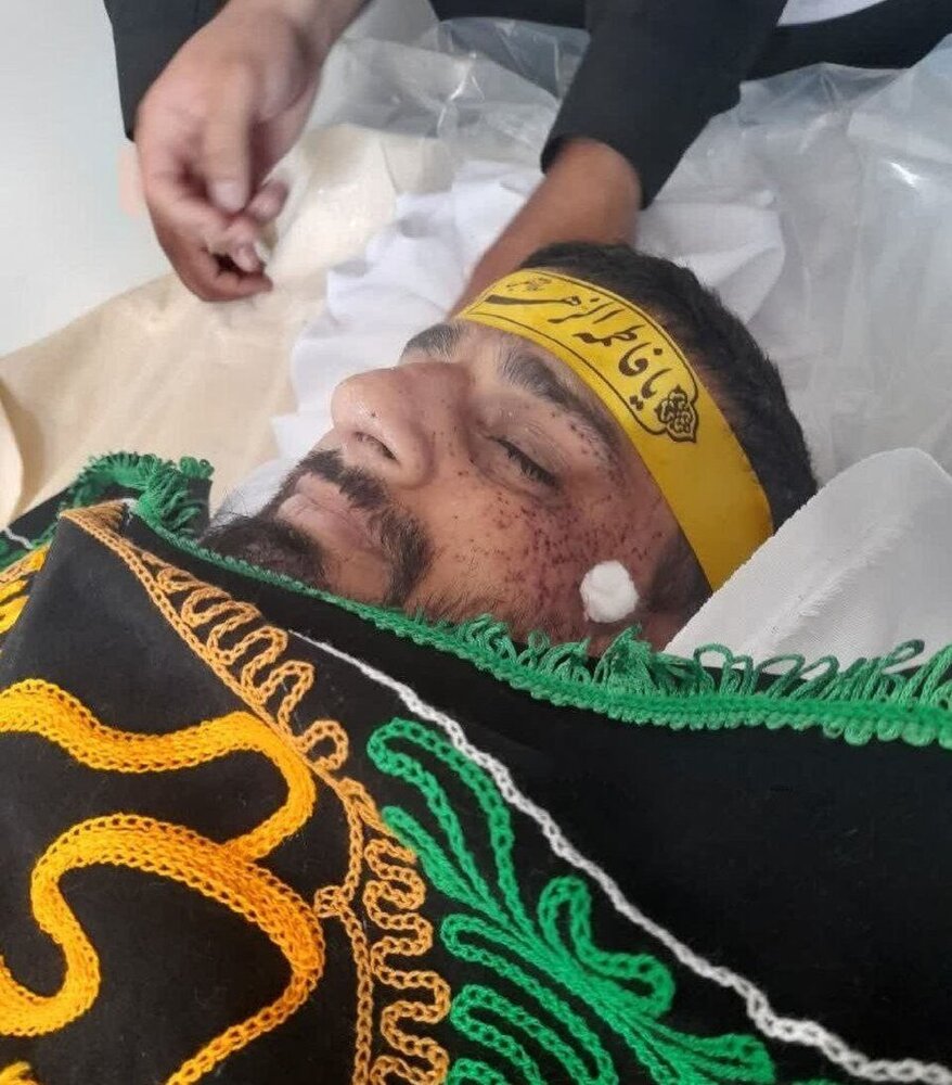 اولین تصویر از امام جماعت زاهدان بعد از ترور