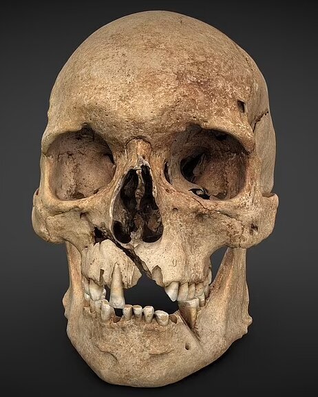 تصاویر | بازسازی چهره مردی که با ضربه تبر به صورتش کشته شد