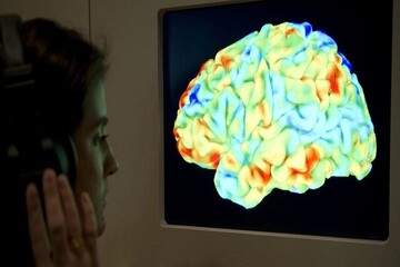 تاثیر ماده سفید مغز بر عملکرد آن محققان را شگفت‌زده کرد!