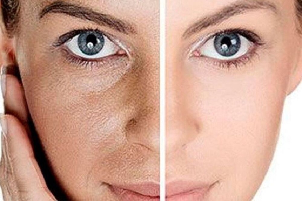 این میوهها برای سلامت پوست معجزه میکنند!