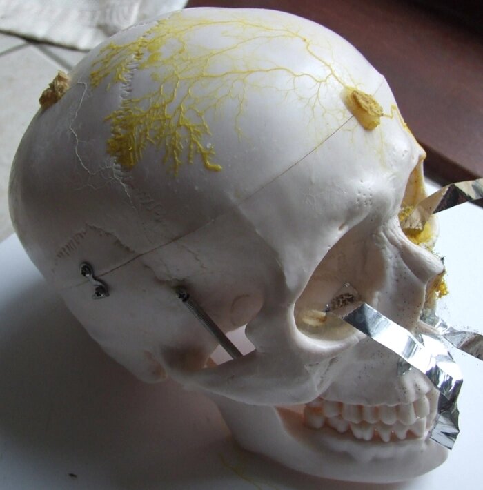 هوش عجیب این موجود بیمغز شگفتزدهتان میکند 3