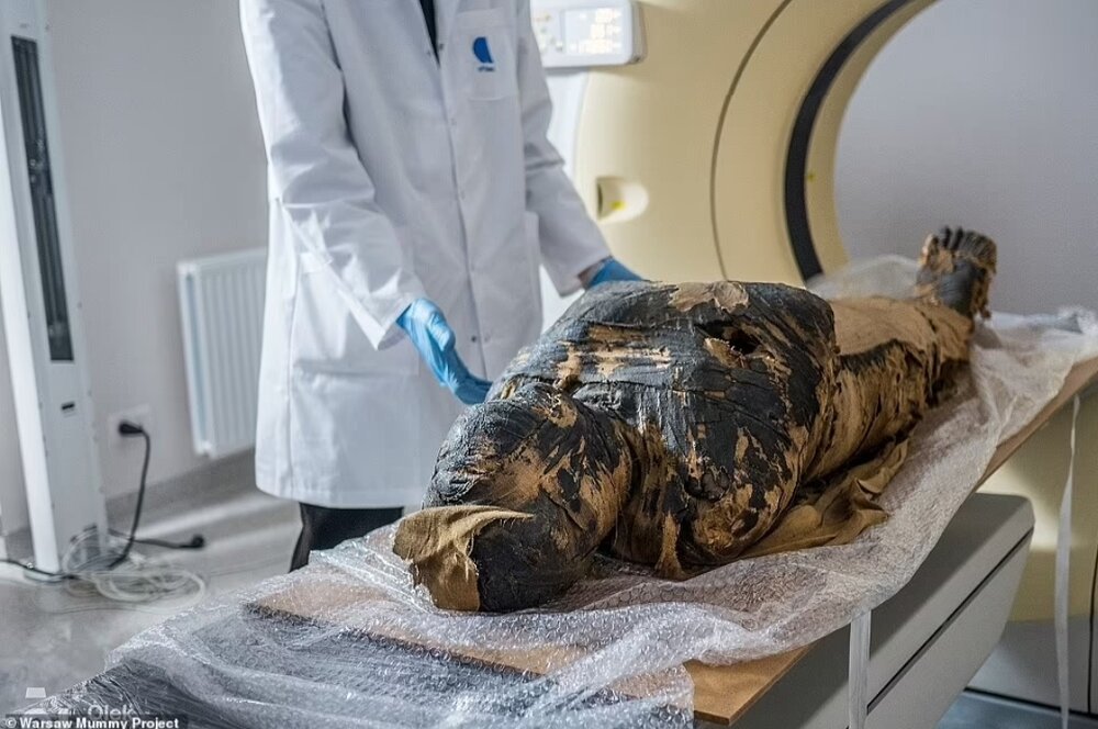 عکس | جنینی که در فرایند مومیایی شدن مادر به شکل خیارشور درآمده بود!