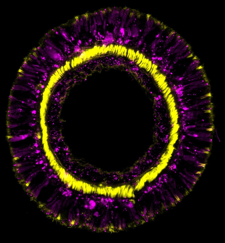 کشف راز جاودانگی یک موجود عجیب / عکس