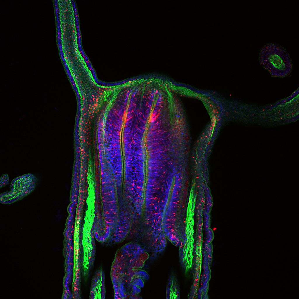 کشف راز جاودانگی یک موجود عجیب / عکس