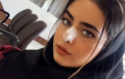 تازهترین روایت: «آیلار» مست بود، تلوتلو میخورد / الگوی ناکارآمد روایتهای رسمی از علت مرگ جانباختگان چیست؟ تازهترین روایت: «آیلار» مست بود، تلوتلو میخورد / الگوی ناکارآمد روایتهای رسمی از علت مرگ جانباختگان چیست؟