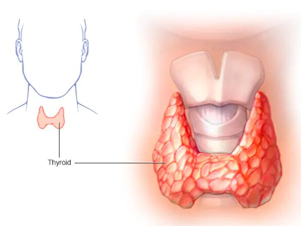 پنج بیماری نادر که به انسان تواناییهای باورنکردنی میدهند
