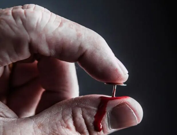 پنج بیماری نادر که به انسان تواناییهای باورنکردنی میدهند