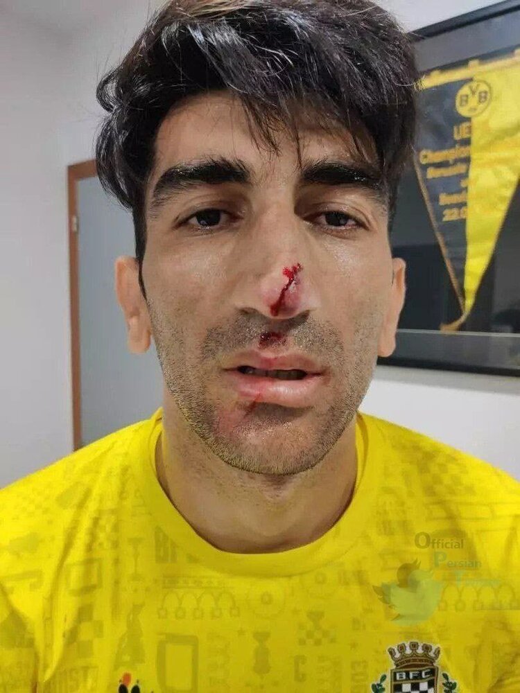 عکس | بیرانوند بعد از مصدومیت در دیدار مقابل انگلیس