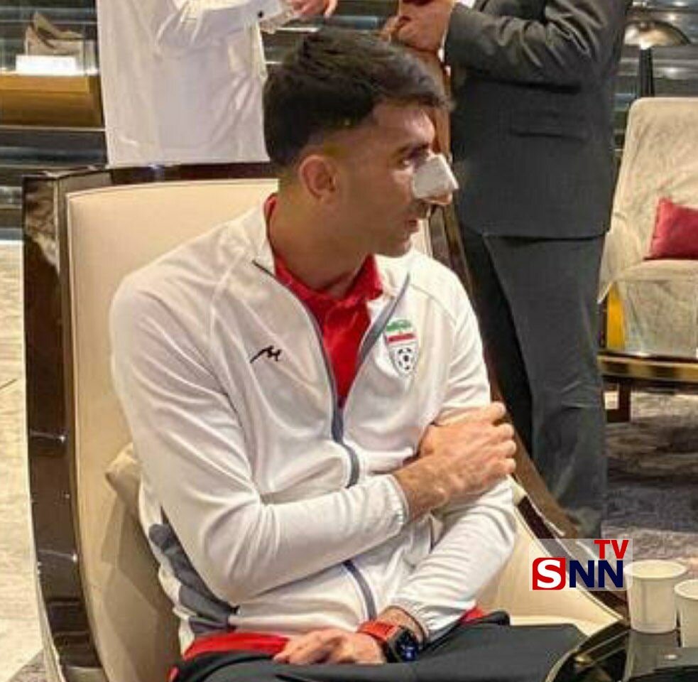 عکس | تصویری خاص از علیرضا بیرانوند با دماغی شکسته