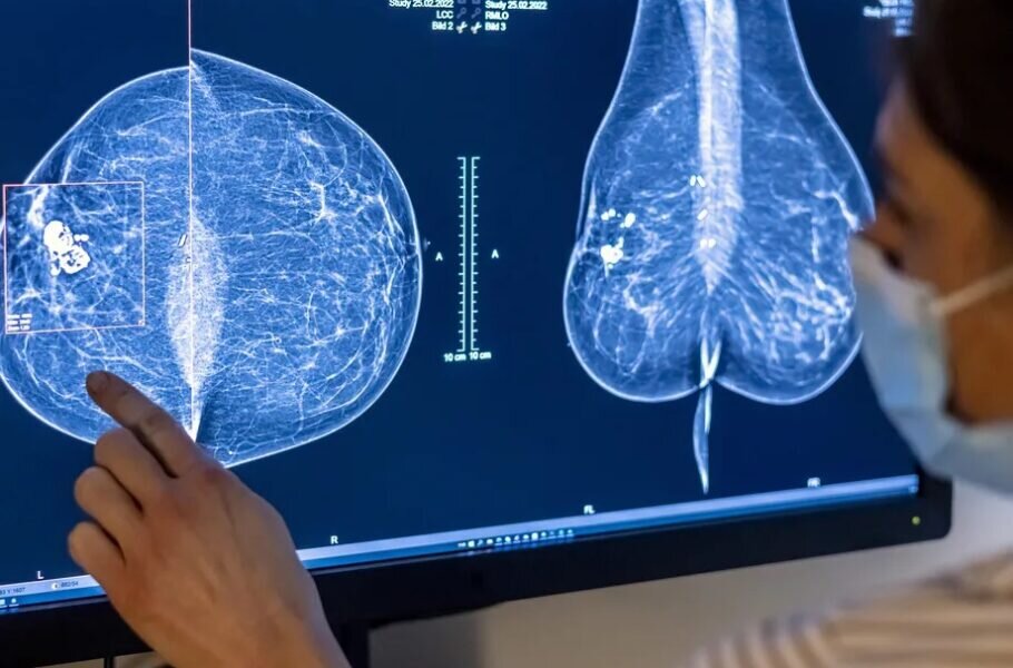 زنان استرالیایی به دنبال برداشتن پروتز پستان