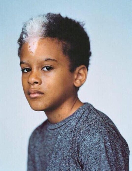 عکس | زیبایی خیرهکننده تیپهای ژنتیکی نادر در انسان