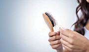 5  مورد از رایج ترین دلایل ریزش مو در خانم ها و آقایان