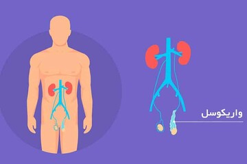 توضیحات دکتر سلمان اسلامی درباره یک عمل جراحی مردانه توضیحات دکتر سلمان اسلامی درباره یک عمل جراحی مردانه